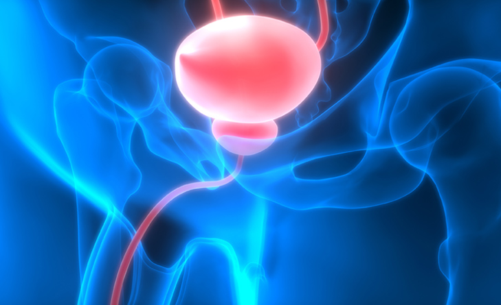 Benign Prostate Conditions