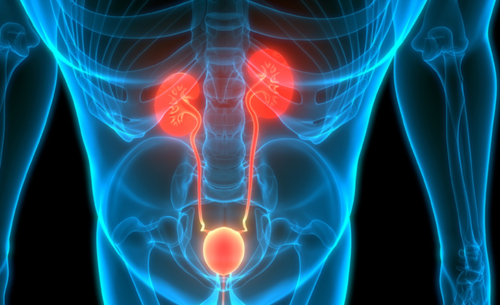 Ureteric strictures