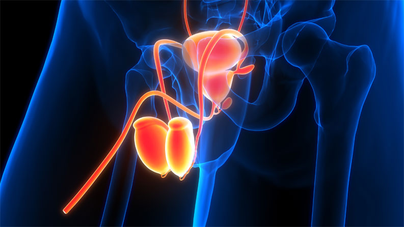 Urethral strictures