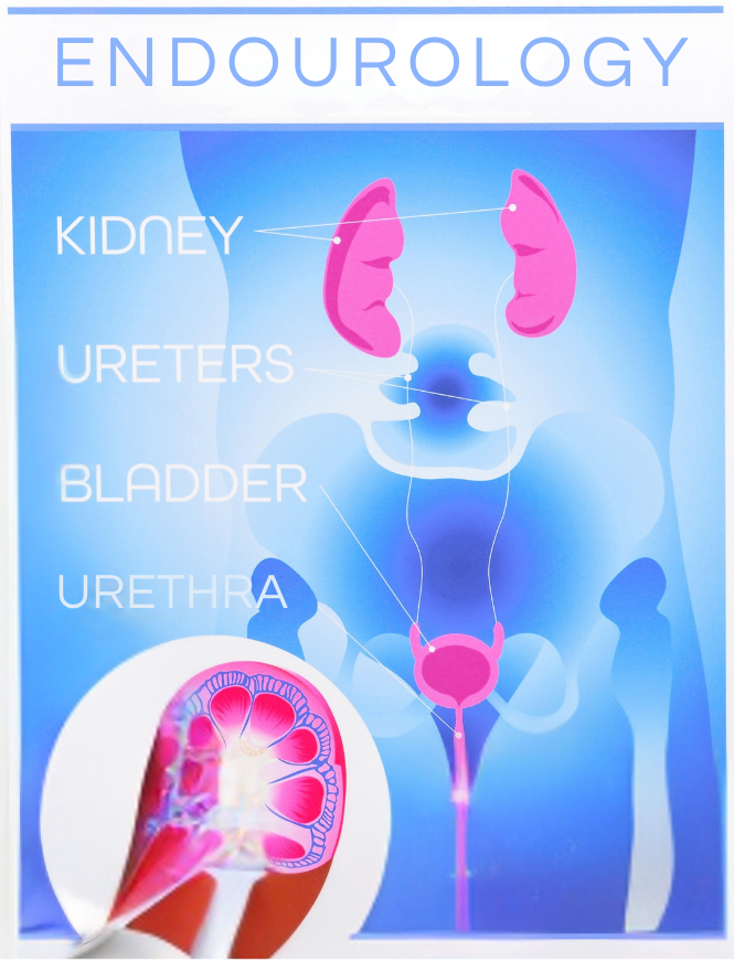 Endourology