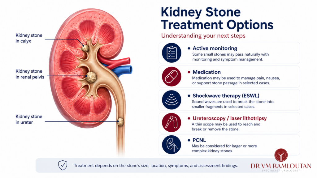 Kidney stone treatment infographic showing stone locations and available treatment options.
